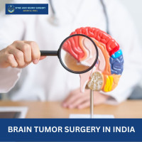 Affordable Brain Tumor Surgery in India