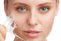Chemical skin peel treatment in Islamabad Enfield Royal Clinics