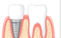 Diamond Dental