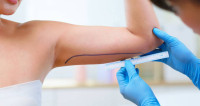 Liposuction surgery in Riyadh
