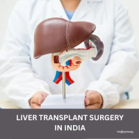 Cost of Liver Transplant Surgery India
