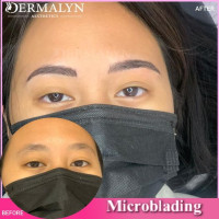 Eyebrow Microblading in Delhi