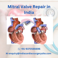 Mitral Valve Repair