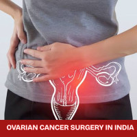 Cost of Ovarian Cancer Surgery in India