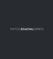 The Tattoo Removal Experts