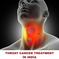 Top Throat Cancer Hospitals in India