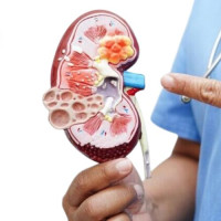 Nephrology Medical Billing