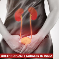 Urethroplasty Surgery Cost In India