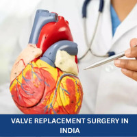 Low Cost Valve Replacement Surgery India