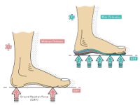 ProFunction Custom Orthotics
