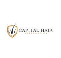 Capital Hair Restoration - Hair Transplant