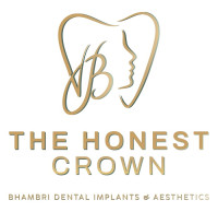 The Honest Crown | Bhambri Dental Implants & Aesthetics